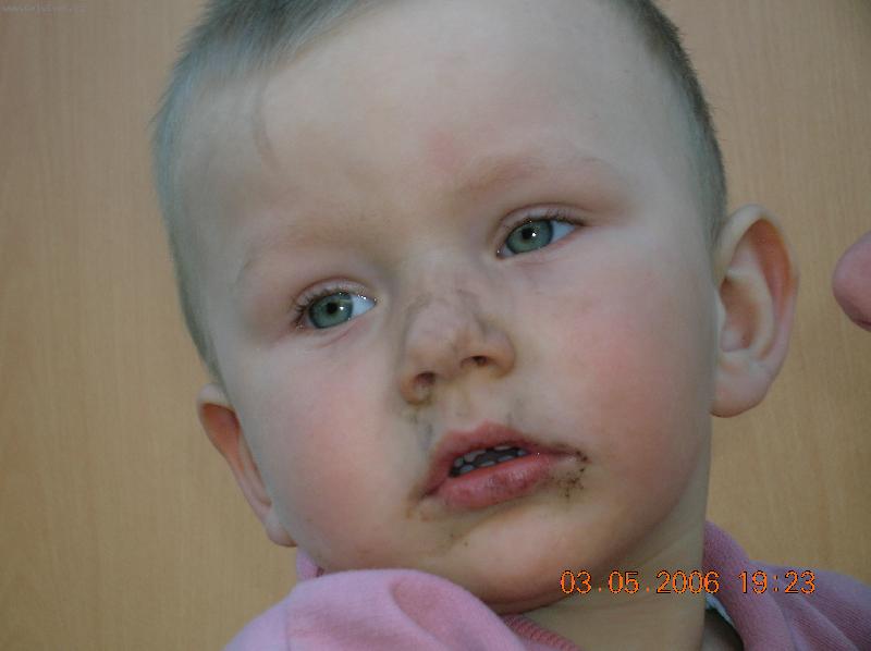 Foto: Patrik-�p�na