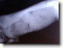 Onkologie - Novotvary ml��n� �l�zy u fen